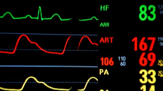 eps_heartmonitor.jpg